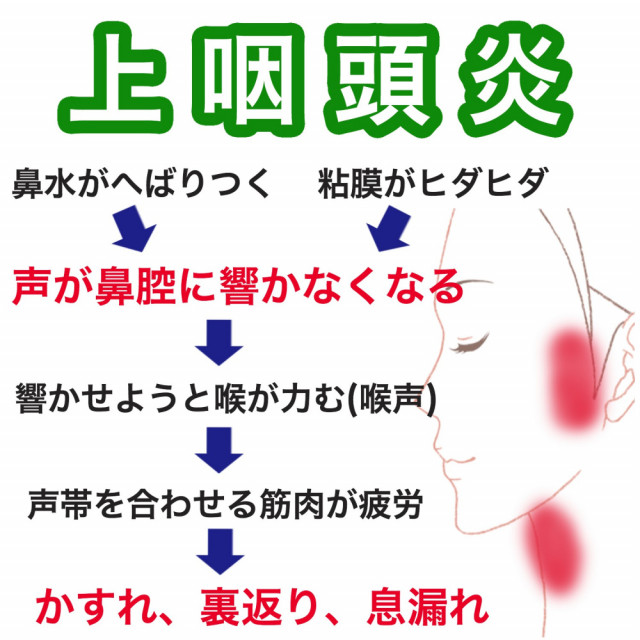 上咽頭炎から声が出なくなるメカニズム